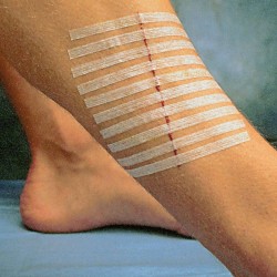 3M Steri Strip Închizătoare de piele ranforsate R1541 6mm x 75mm 3 buc 3M Steri Strip Închizătoare de piele ranforsate R1541 6mm x 75mm 3 buc