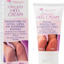 Vican Carnation Cracked Heel Cream 50ml - Cracked Heel Cream Vican Carnation Cracked Heel Cream 50ml - Cracked Heel Cream