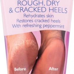 Vican Carnation Cracked Heel Cream 50ml - Cracked Heel Cream Vican Carnation Cracked Heel Cream 50ml - Cracked Heel Cream
