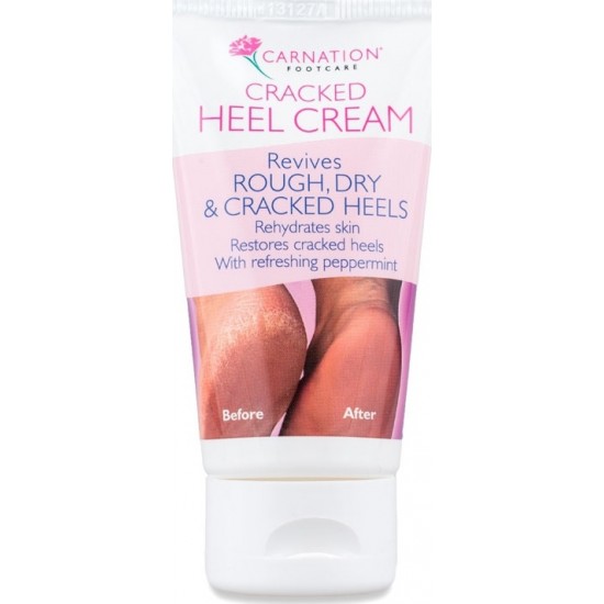 Vican Carnation Cracked Heel Cream 50ml - Cracked Heel Cream